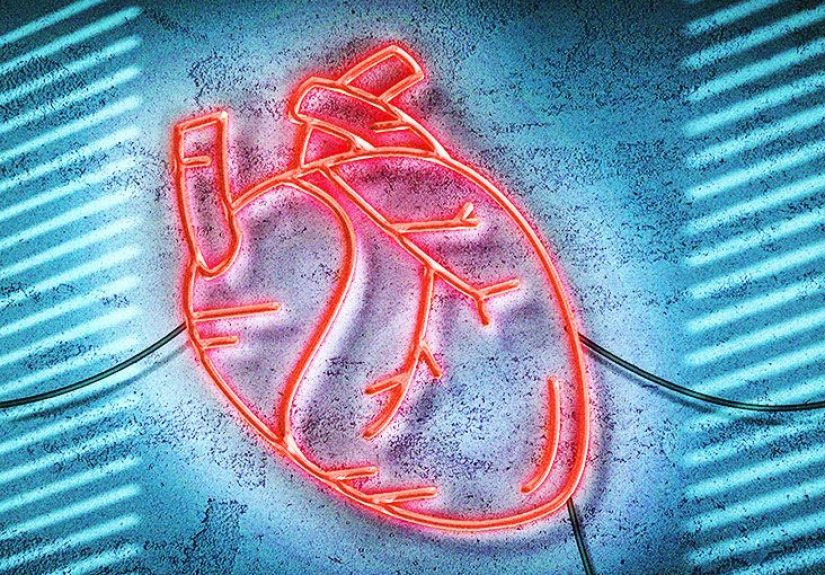 5 Common Vascular Procedures and Surgeries