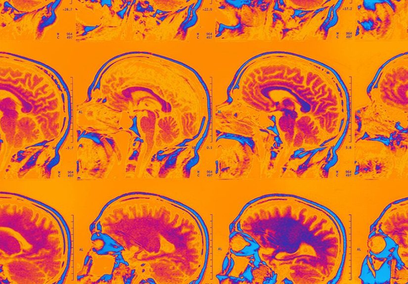 ADHD and the Brain I Psych Central