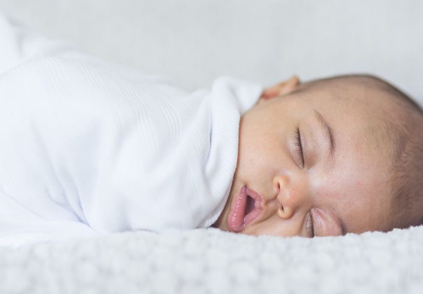 Baby Acne: Causes, Symptoms, and Treatment