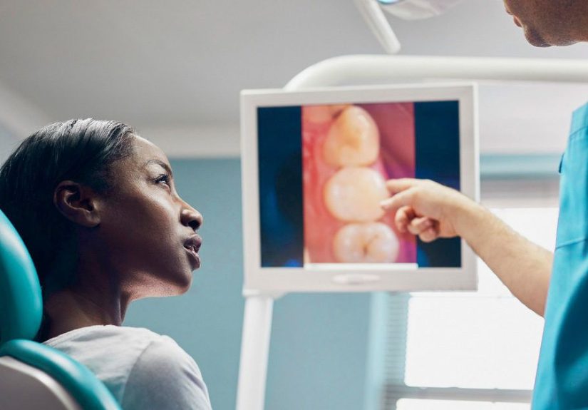 Do Tooth Worms Exist? Myths Debunked, and Causes of Decay