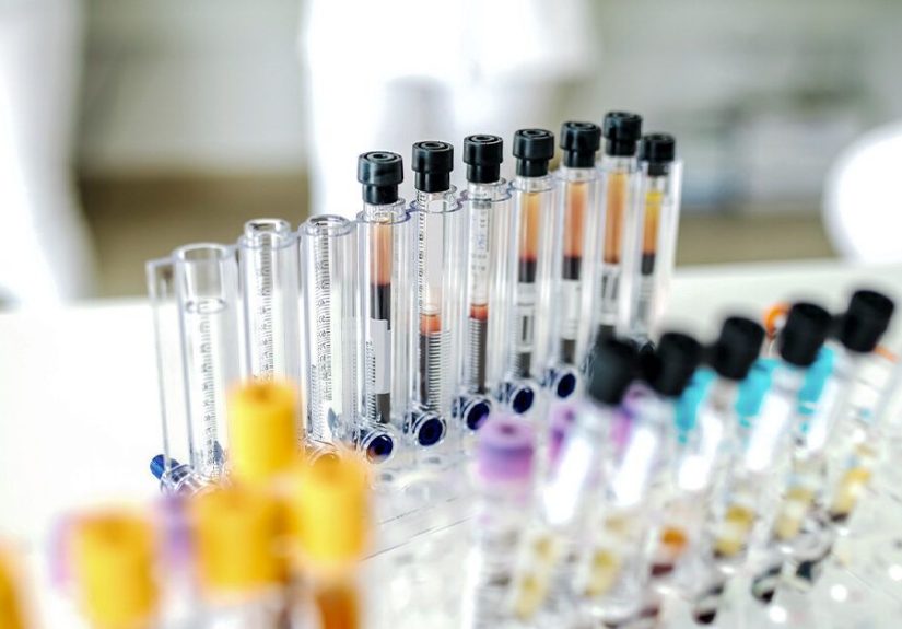 Intraepithelial Lymphocytosis: Causes, Symptoms, Treatment