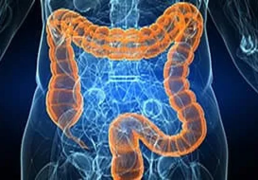Virtual Colonoscopy Procedure Video