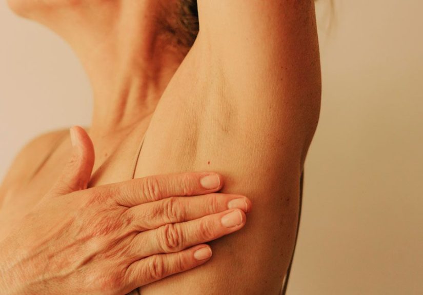 Hidradenitis Suppurativa Tunnels: Photos, Treatments, and More