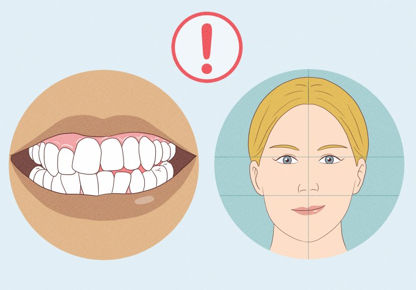 How to Get Facial Forward Growth: What Really Works?