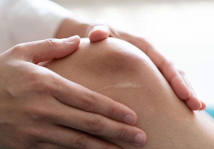 Random bruising: Causes, treatment, and prevention