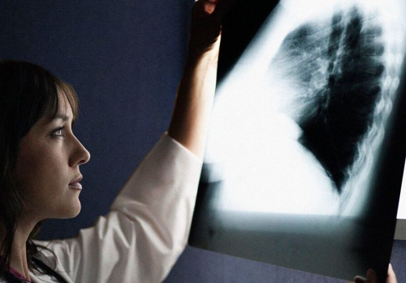 Where and How Breast Cancer Spreads