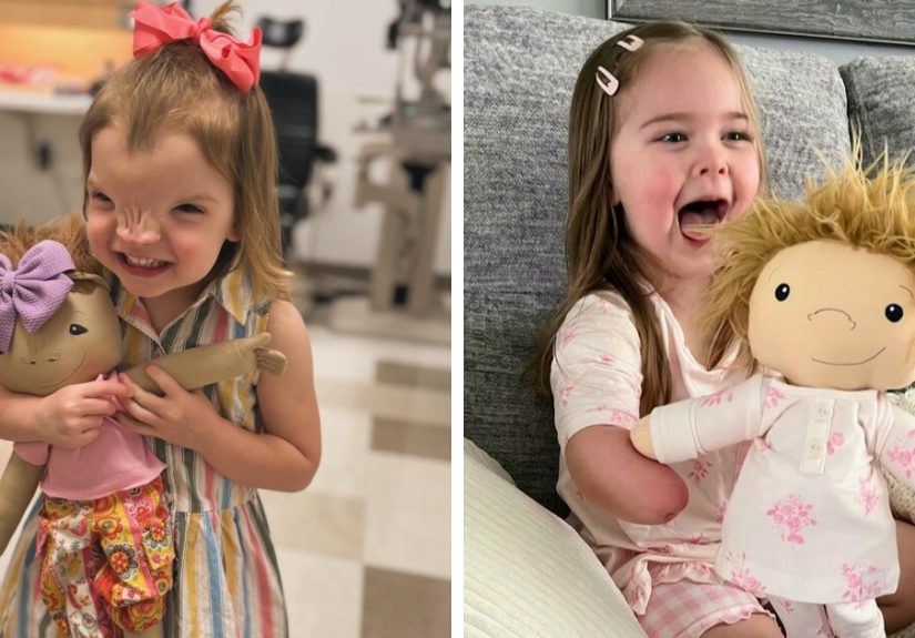 Woman Creates Dolls That Fit Each Child’s Needs While Representing Their Rare Health Conditions (26 New Pics)