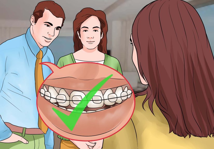3 Ways to Make Braces Look Less Noticeable