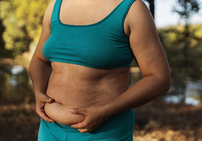 Belly Bulge Types and What You Can Do to Treat Them