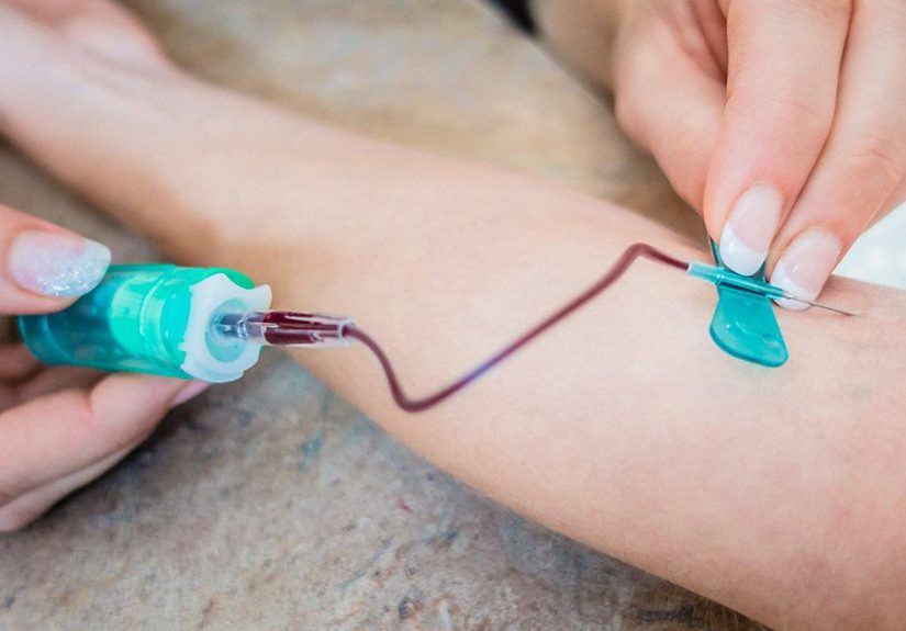 Butterfly Needle for Blood Draw: How It Works and Why It’s Used