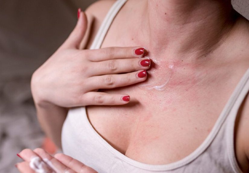 Eczema and Pimples: What If You Have Both?