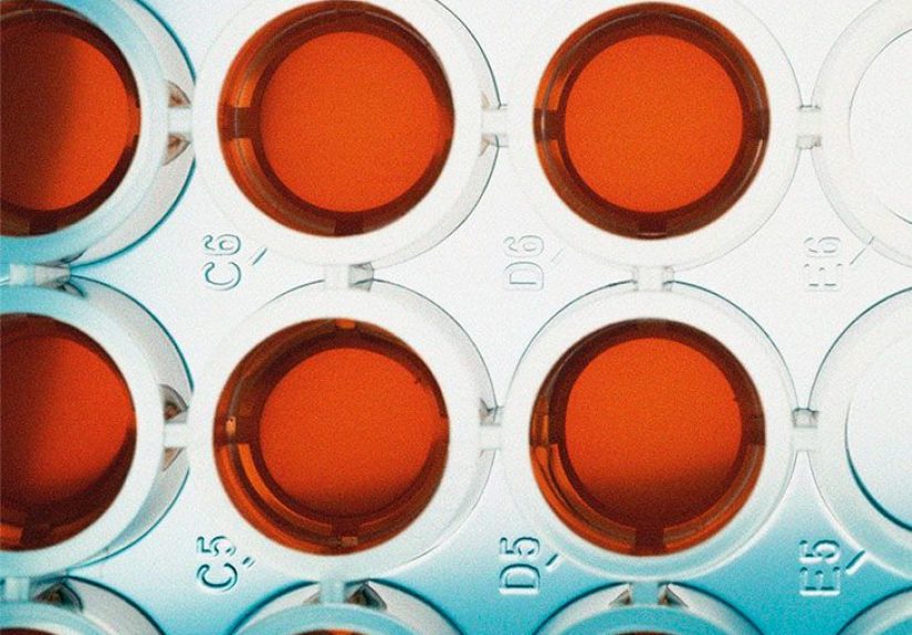How Biomarkers Can Target Treatment of Lung Cancer in Nonsmokers