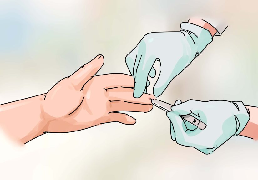 How to Be Intimate When One Partner Has Herpes: 10 Smart Steps