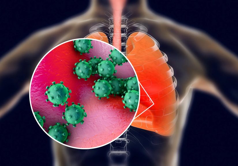Infección por adenovirus: síntomas y tratamiento