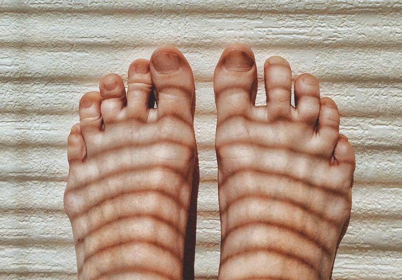 Red Toes: Symptoms, Causes, and Treatments