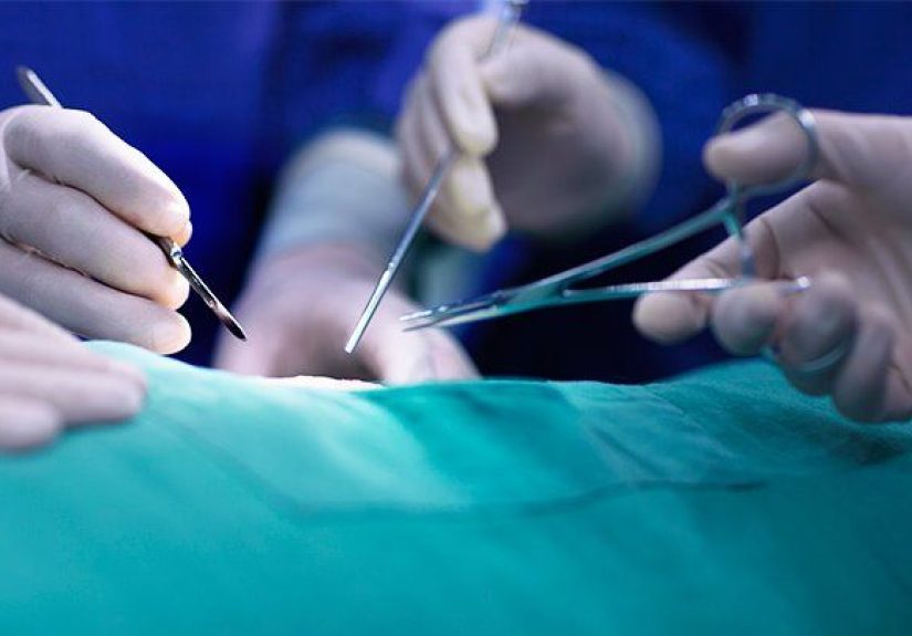 What Is an Appendectomy? Surgery and Recovery