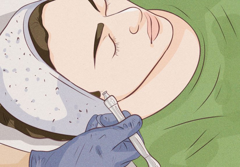 4 Ways to Remove Sideburns (For Girls)