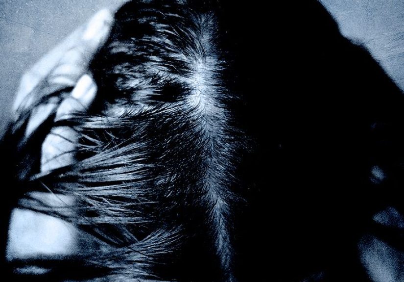 Biotin for Hair Growth: Dosage and Side Effects