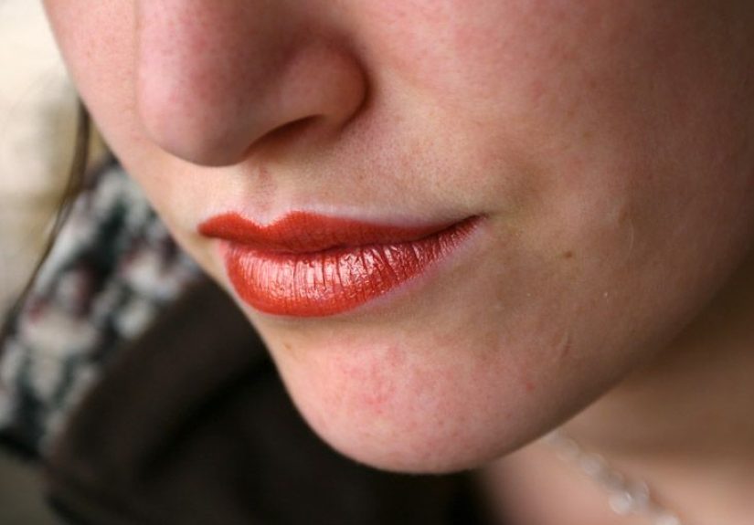 HIV-Related Mouth Sores: What They Look Like and How They’re Treated