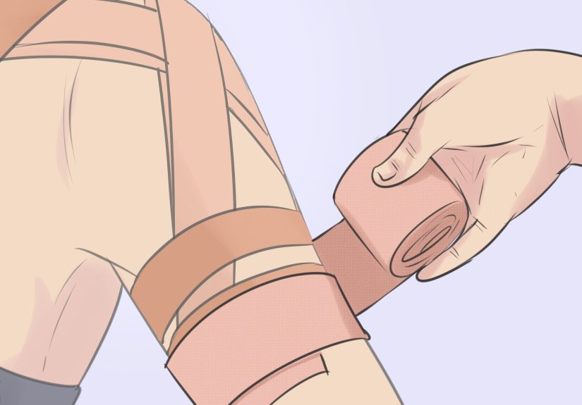 How to Strap a Dislocated Shoulder: 9 Steps