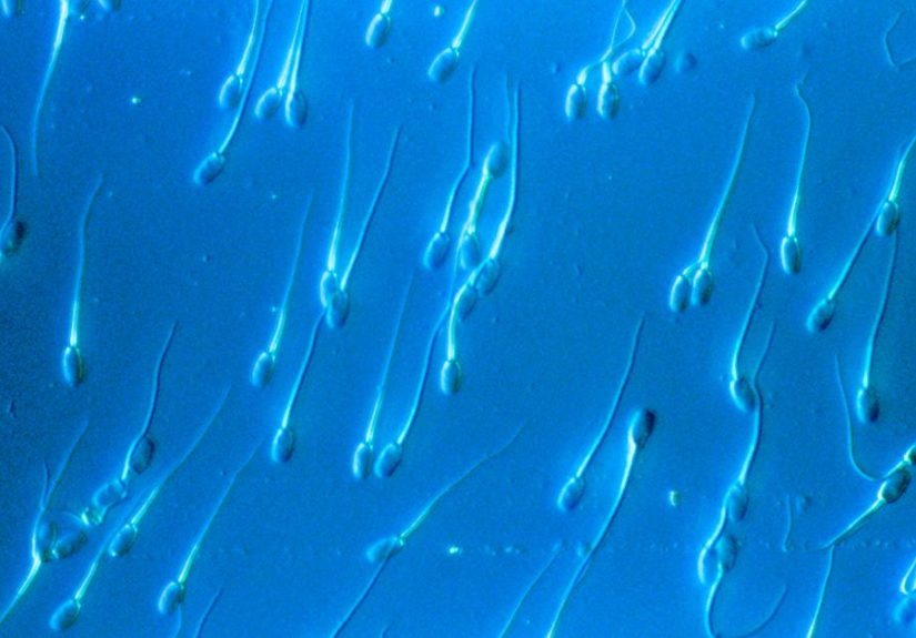 Normal Sperm Count: Understanding Your Semen Analysis