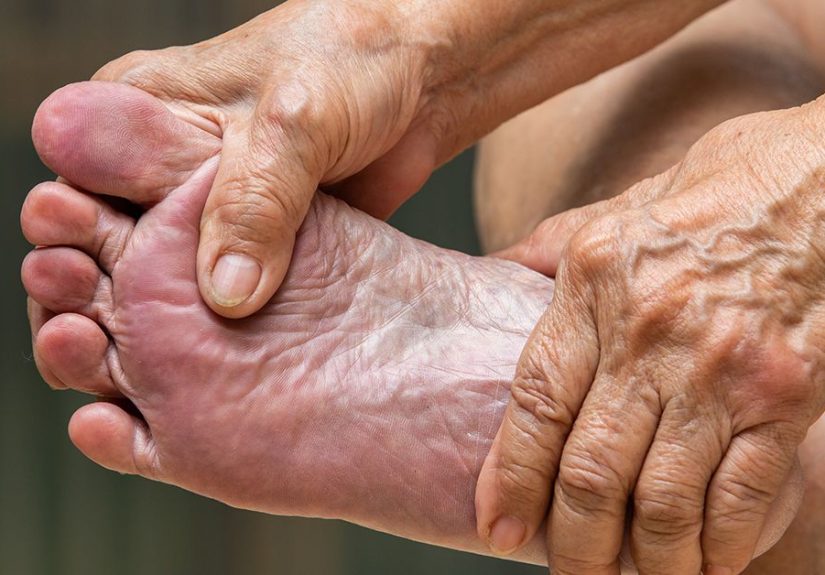Plantar Vein Thrombosis: Symptoms, Diagnosis, and Treatment