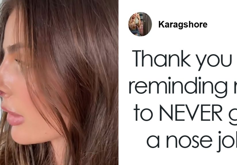 “See The Potential”: Woman Brutally Trolled After Rhinoplasty Defends The Results