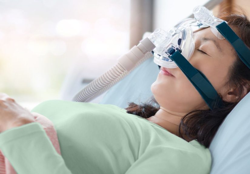 Treating Mild Obstructive Sleep Apnea